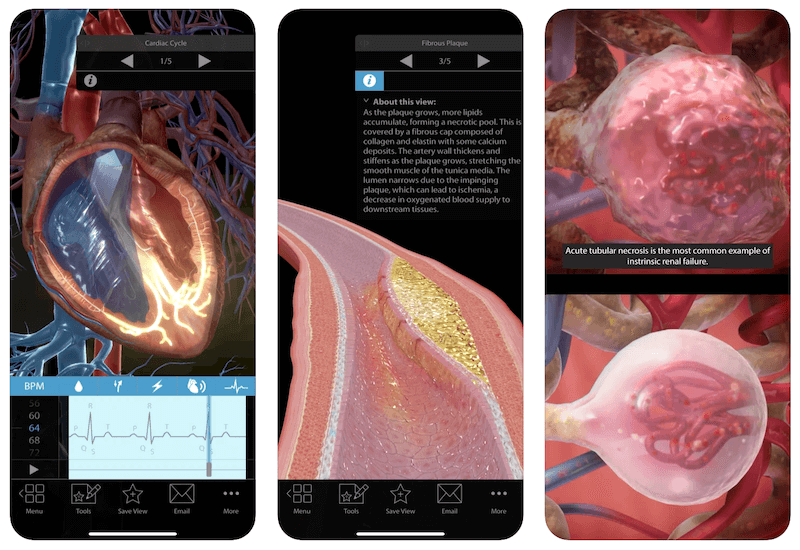 ung dung Physiology Pathology iphone